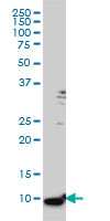 WB - S100A6 Antibody (monoclonal) (M16) AT3760a